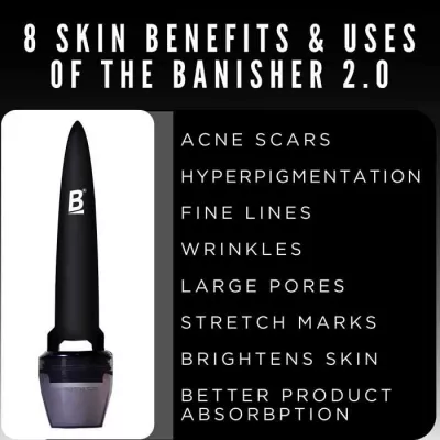 BANISH, najlepsza pielęgnacja zwykłych blizn potrądzikowych : 8 korzyści dla skóry i zastosowań BANISHER 2.0 do leczenia blizn potrądzikowych w domu